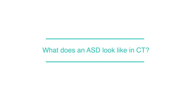 What does an ASD look like in CT?