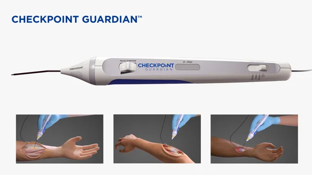 Checkpoint Nerve Stimulator & Locator - Locate & Map Nerve Function