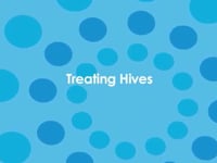 Hives