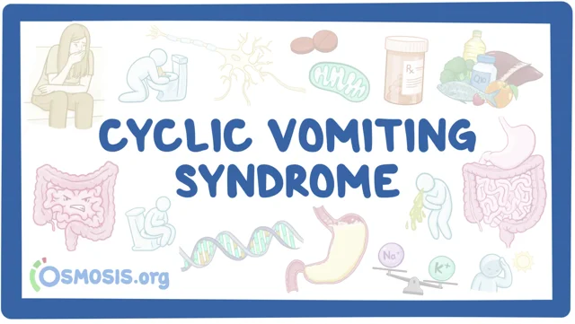 Cyclic Vomiting Syndrome - Symptoms, Causes, Treatment