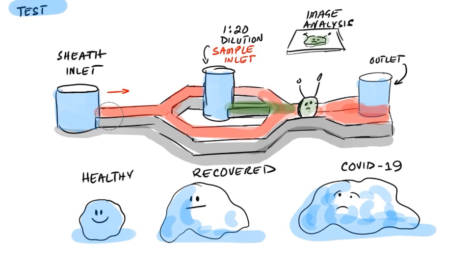 COVID-19 Causes Long-Term Blood Cell Changes