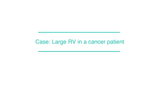 Case: Large RV in a cancer patient