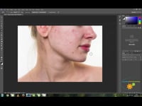 Imperfection Treatment