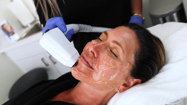 Acoustic SoftWave® Therapy in Beverly Hills, CA - Stem Cell