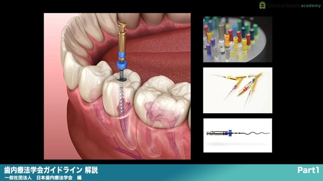 ポイント解説『歯内療法学会ガイドライン』 | Doctorbook academy