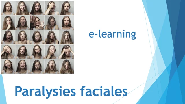 00 Formation e-learning Paralysies Faciales
