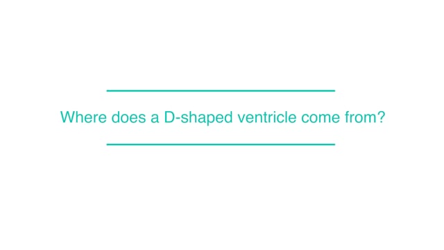 Where does a D-shaped ventricle come from?