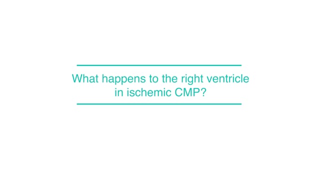 What happens to the right ventricle in ischemic CMP?