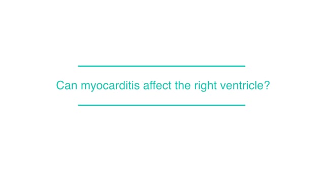 Can myocarditis affect the right ventricle?