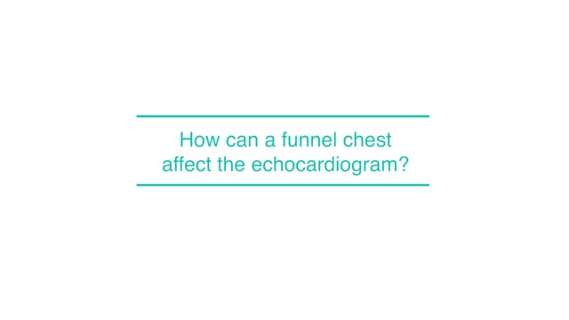 How can a funnel chest affect the echocardiogram?