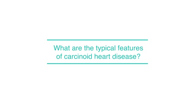 What are the typical features of carcinoid heart disease?