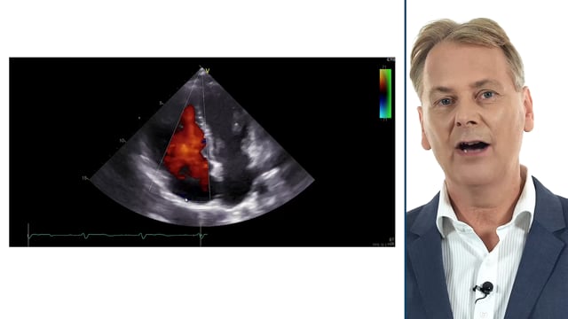 Case: ASD in a young female