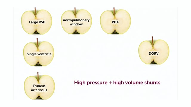 What is Eisenmenger syndrome?