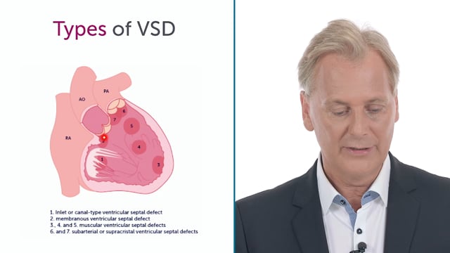 How can I assess ventricle septum defects?