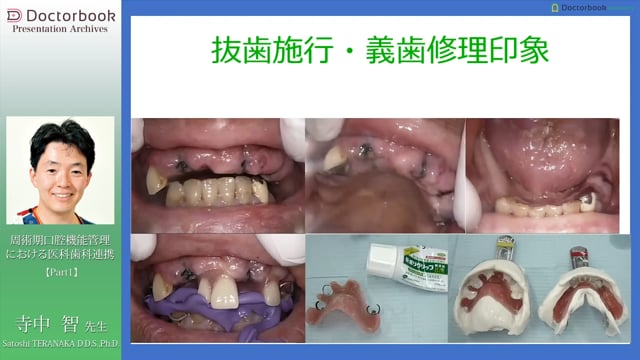 周術期口腔機能管理における医科歯科連携