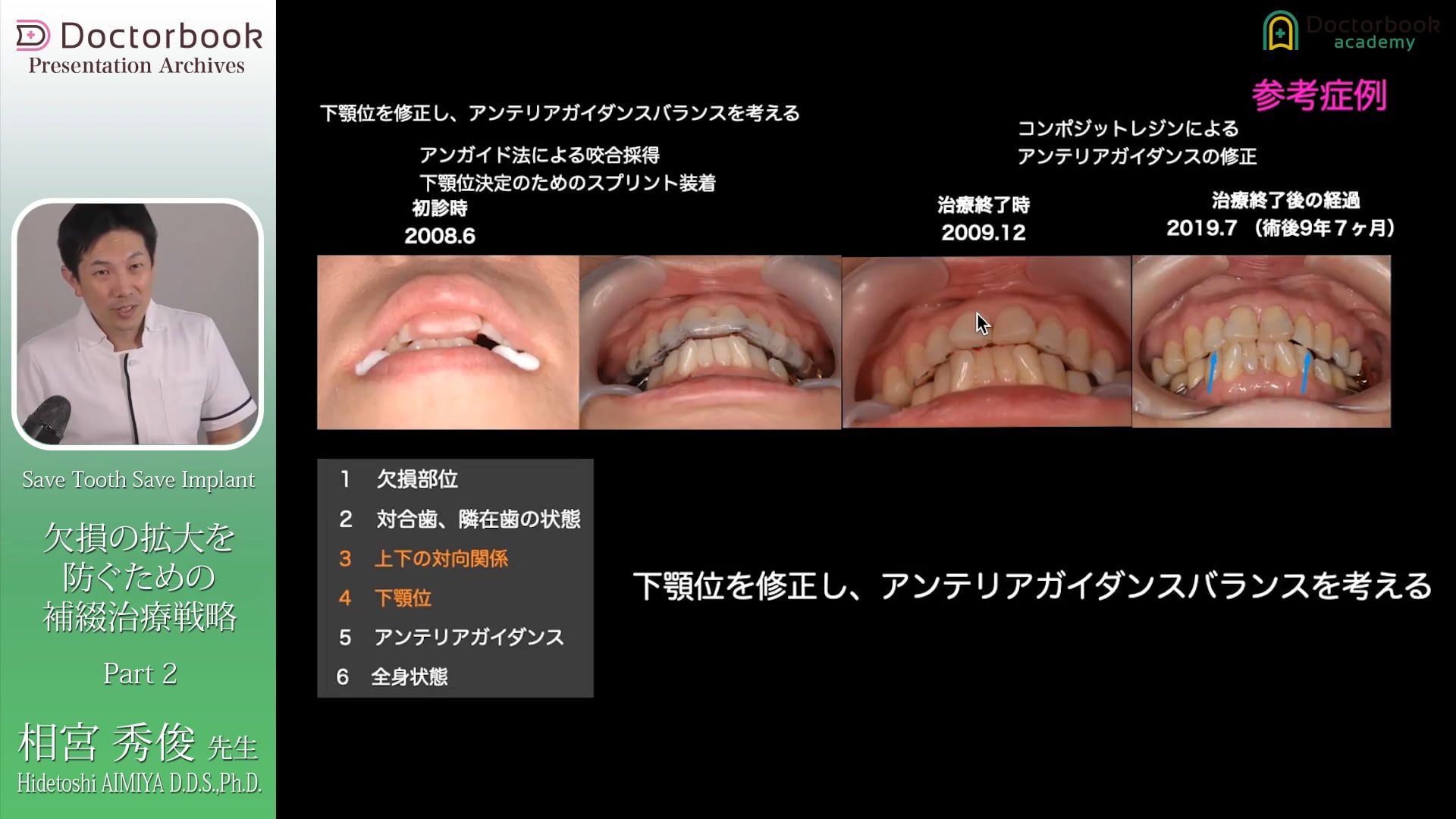 #2 欠損に対する治療戦略と臨床例