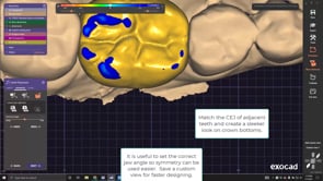 Single Tooth and Abutment.mp4