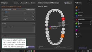 Single Molar and Abutment, New Design.mp4