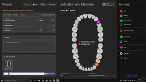 Screw Retained Crown Design.mp4