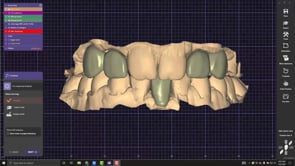 Model Creator for Tissue with Single Die Bridges