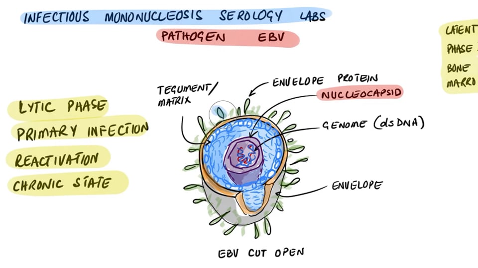 Epstein Barr Virus (EBV) Serology