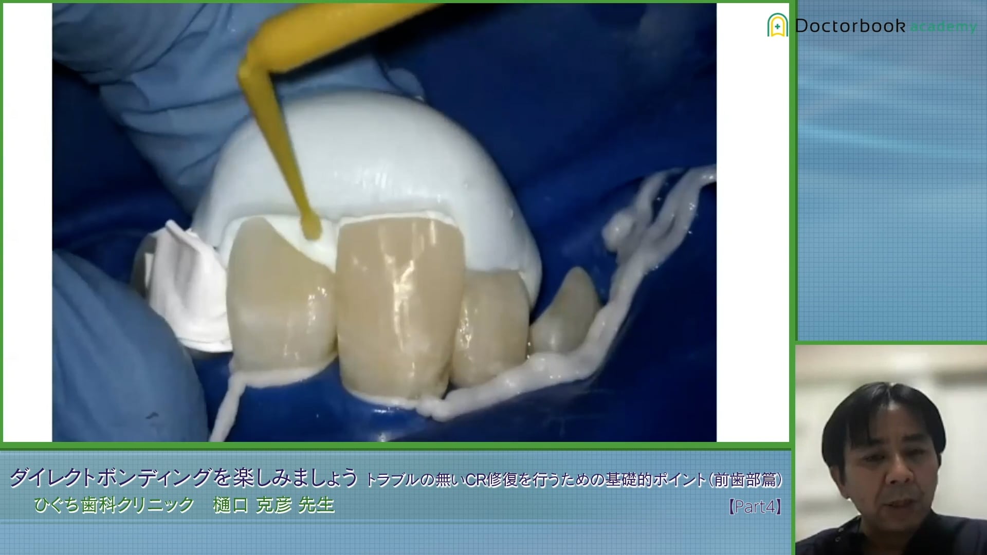 #4 歯頸部CRのリカバリー症例