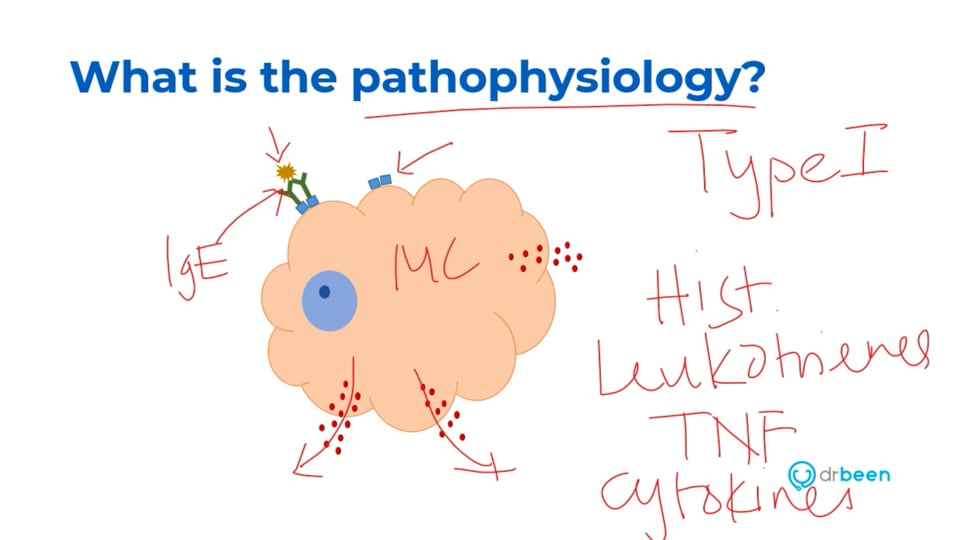 Anaphylaxis with Dr. Faraaz Bhatti