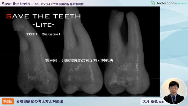 Save the teeth−Lite−オンラインで学ぶ歯の保存の重要性 「 第三回：分岐部病変の考え方と対処法」