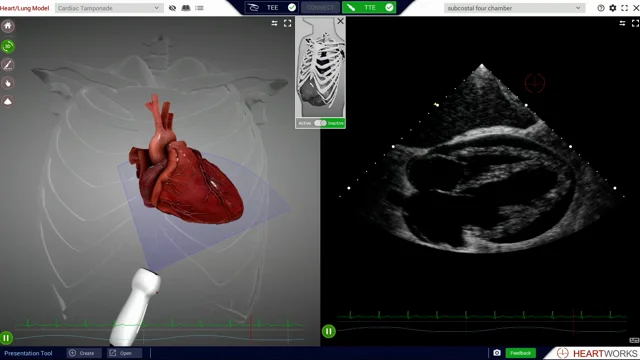 test album – POCUS Journal