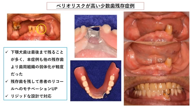 #2 症例を見ながらみんなで考えてみよう！和田先生編