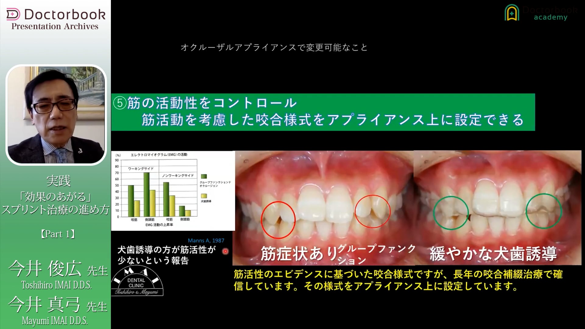 #1 オクルーザルアプライアンスの目的