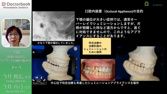 実践「効果のあがる」スプリント治療のすすめ方 | Doctorbook academy 