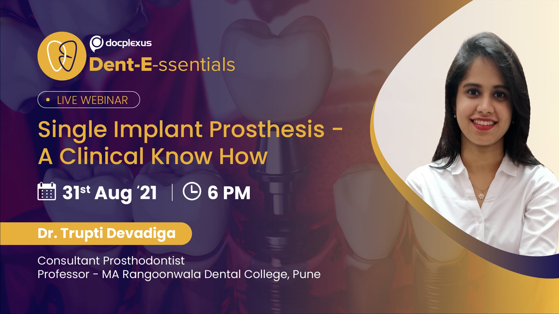 Single Implant Prosthesis - A Clinical Know-how