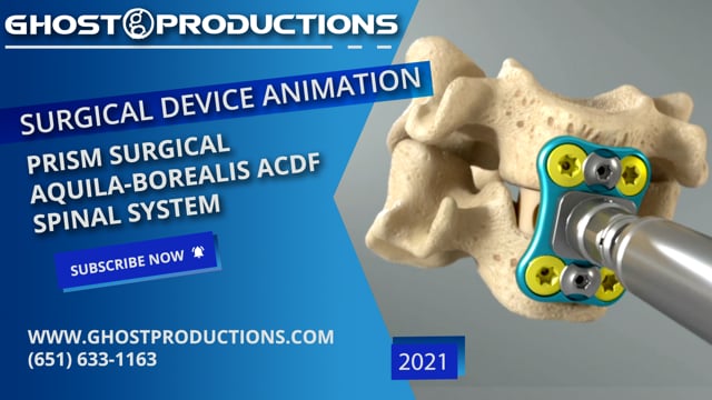 Spine Surgery & Neurology Animation I Ghost Medical
