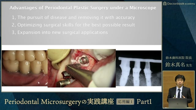 #1 Periodontal Microsurgeryの特徴