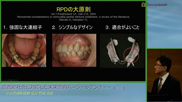 #3 パーシャルデンチャーの目的