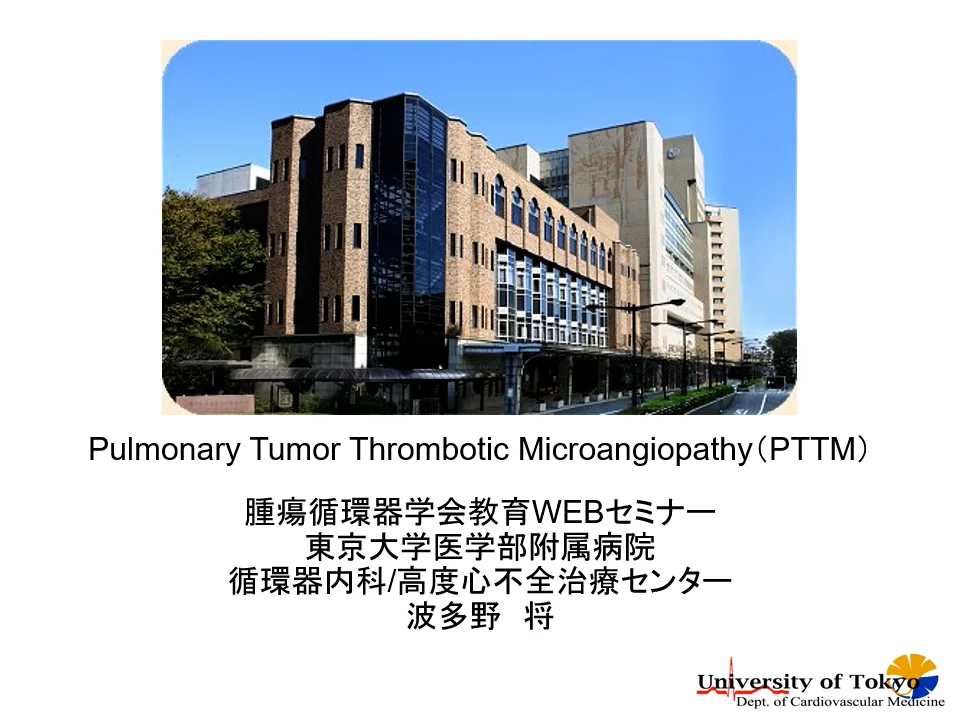 肺腫瘍血栓性微小血管症（PTTM） - 一般社団法人日本腫瘍循環器学会