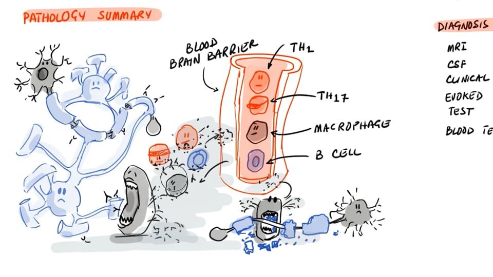 Multiple Sclerosis-Clinical Aspects