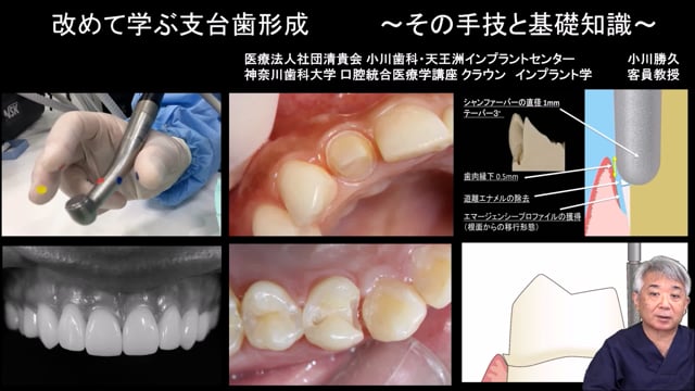 改めて学ぶ支台歯形成 ～その手技と基礎知識～