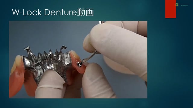 第1回 導入編 #2  W-Lock Denture・回転着脱・IBA義歯設計装置