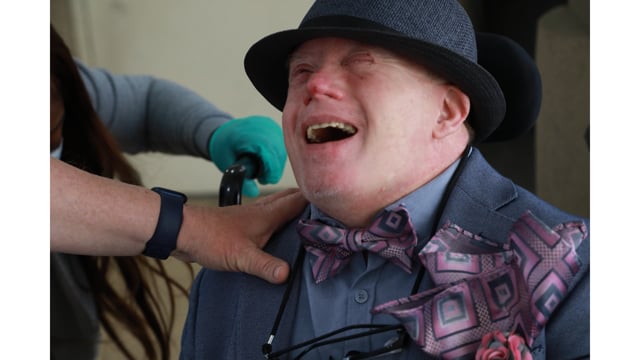 New Video on Early-Onset Alzheimer's and Down Syndrome