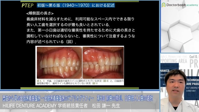 前歯の排列、臼歯部人工歯の選択│歴史から学ぶ全部床義歯臨床 〜全部床義歯臨床のビブリオグラフィ〜 第5回