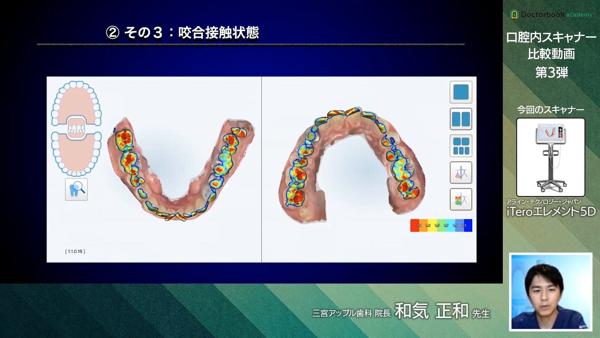 【口腔内スキャナー比較動画】第3弾 〜アライン・テクノロジー・ジャパン iTeroエレメント5D〜