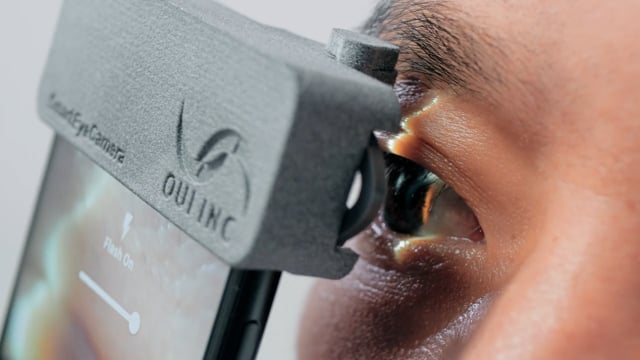 OUI – Healthcare Explainer Video