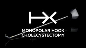 cholecystectomy