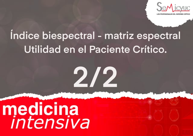 Índice Bispectral Lateral - Parte 2