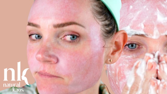 25% TCA Peel #1 Natural Kaos Skincare Chemical Peel