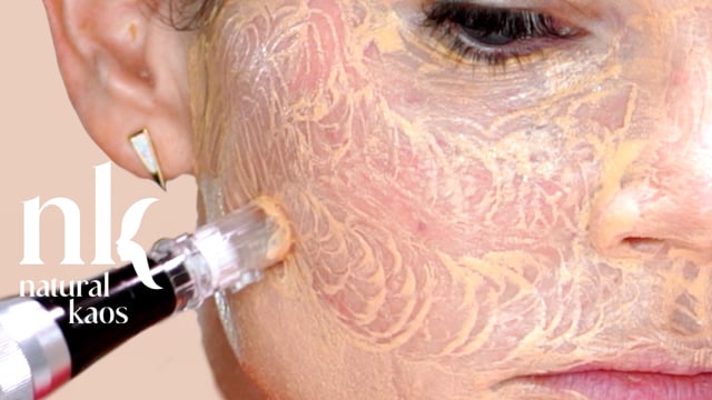 BB Glow Experience Covering Meso Bruises Natural Kaos Skincare