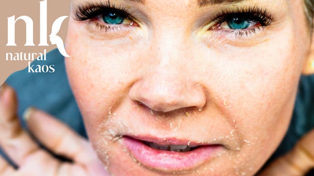 Miracle Acid Peel Natural Kaos Skincare