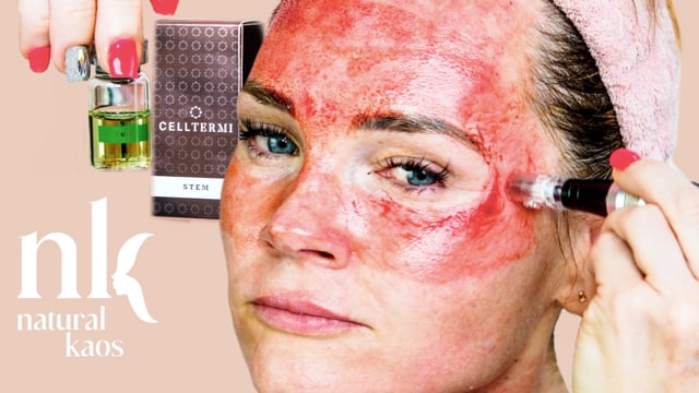 ILLUMA Pen Microneedling w/ Celltermi Stem Natural Kaos Skincare